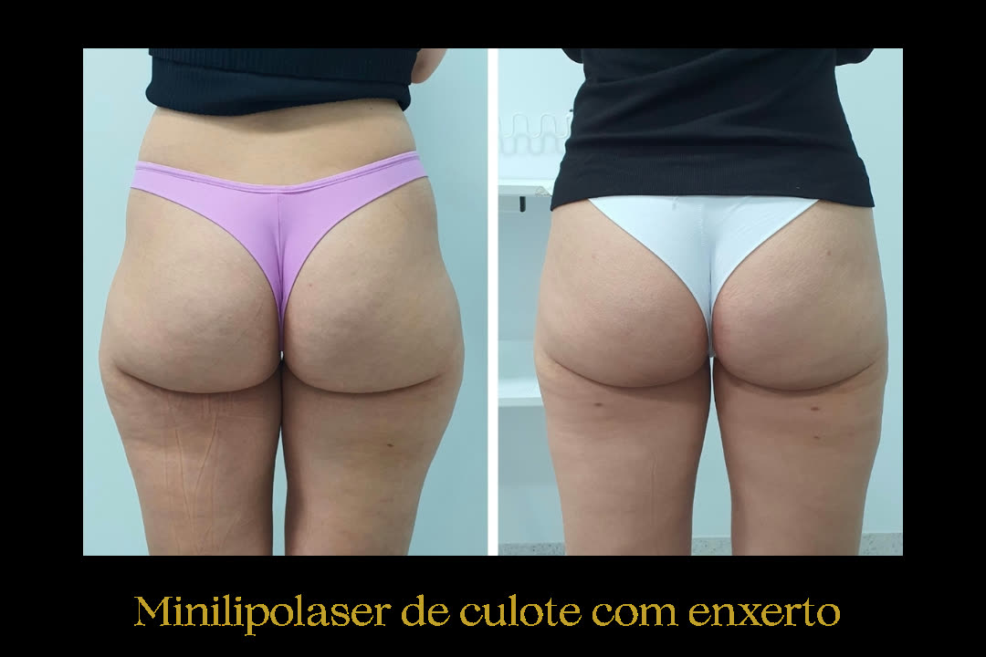Caso 10