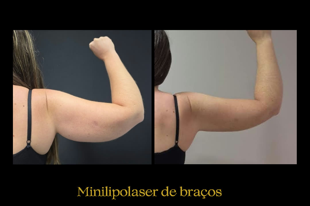Caso 11