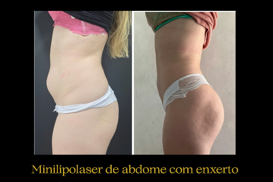 Caso 7