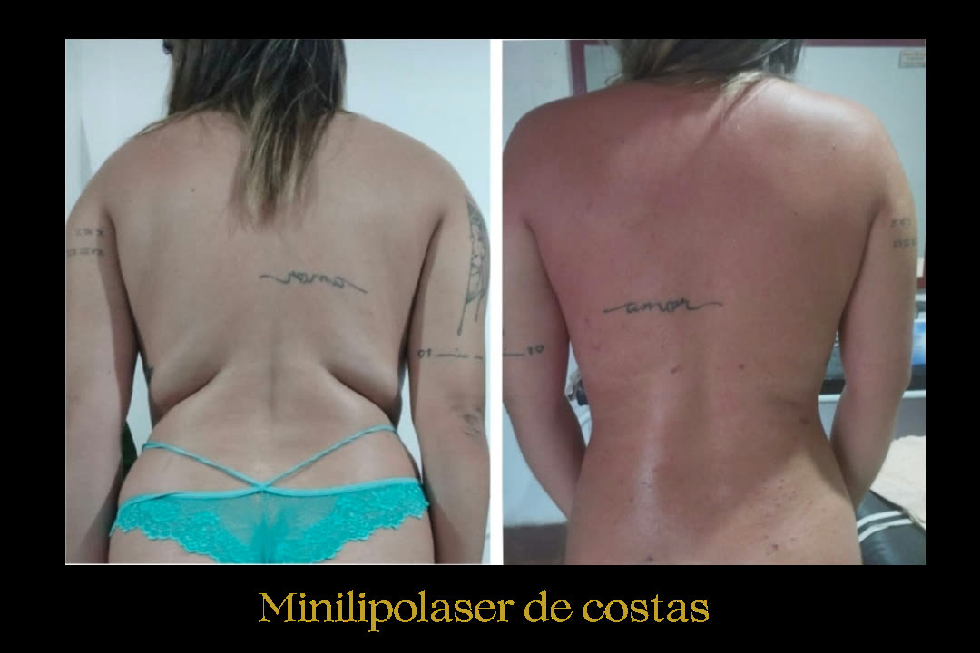 Caso 8