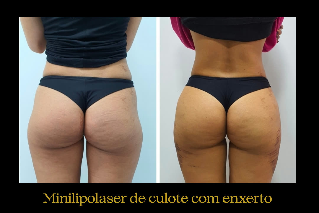 Caso 9