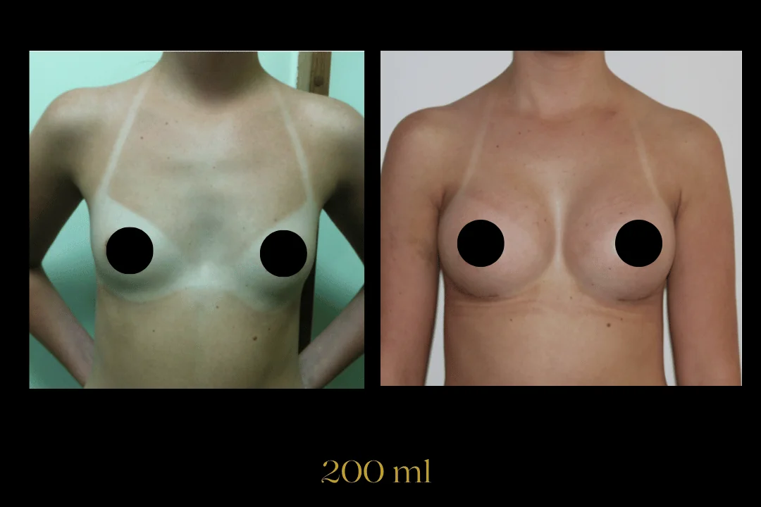 Caso 1 — antes e depois