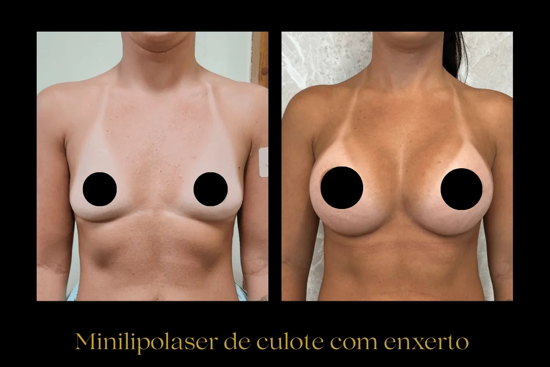 Caso 10 — antes e depois