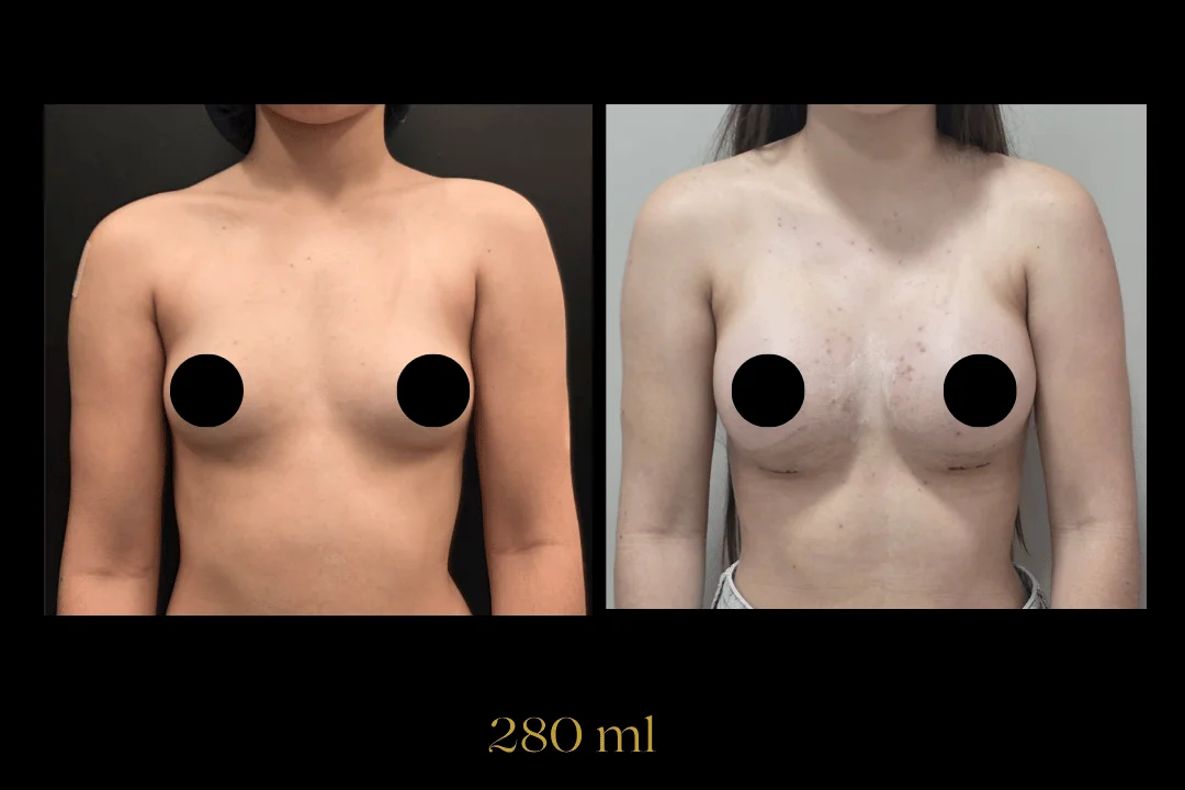 Caso 12 — antes e depois