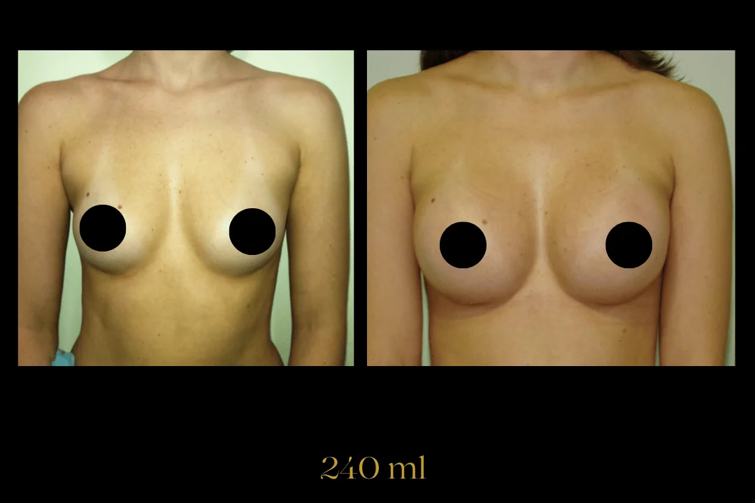 Caso 2 — antes e depois