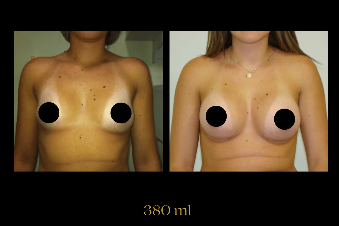 Caso 3 — antes e depois