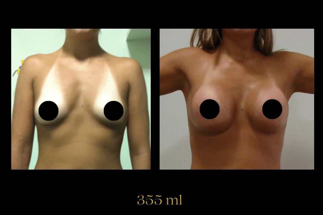 Caso 4 — antes e depois