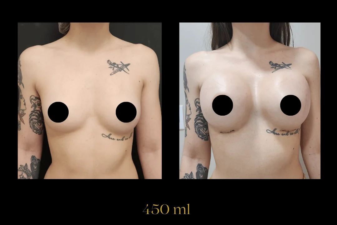 Caso 5 — antes e depois