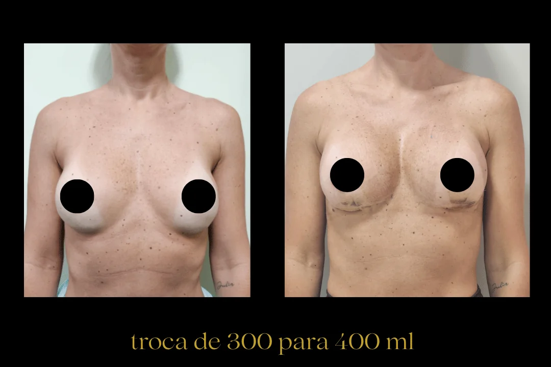 Caso 6 — antes e depois