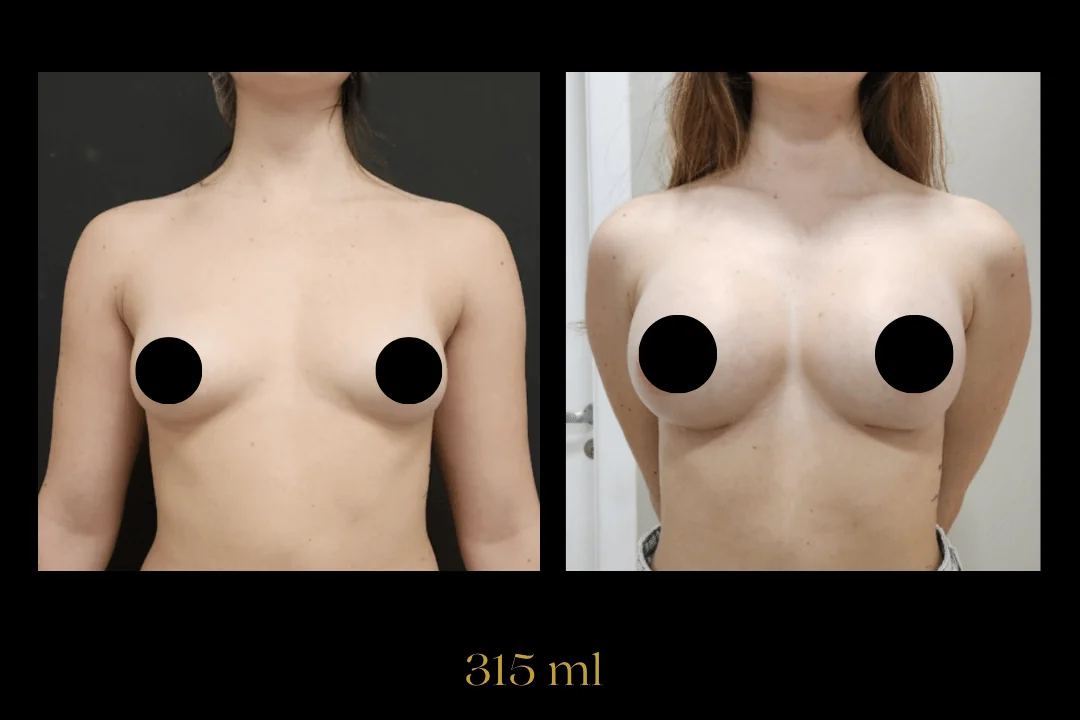 Caso 7 — antes e depois