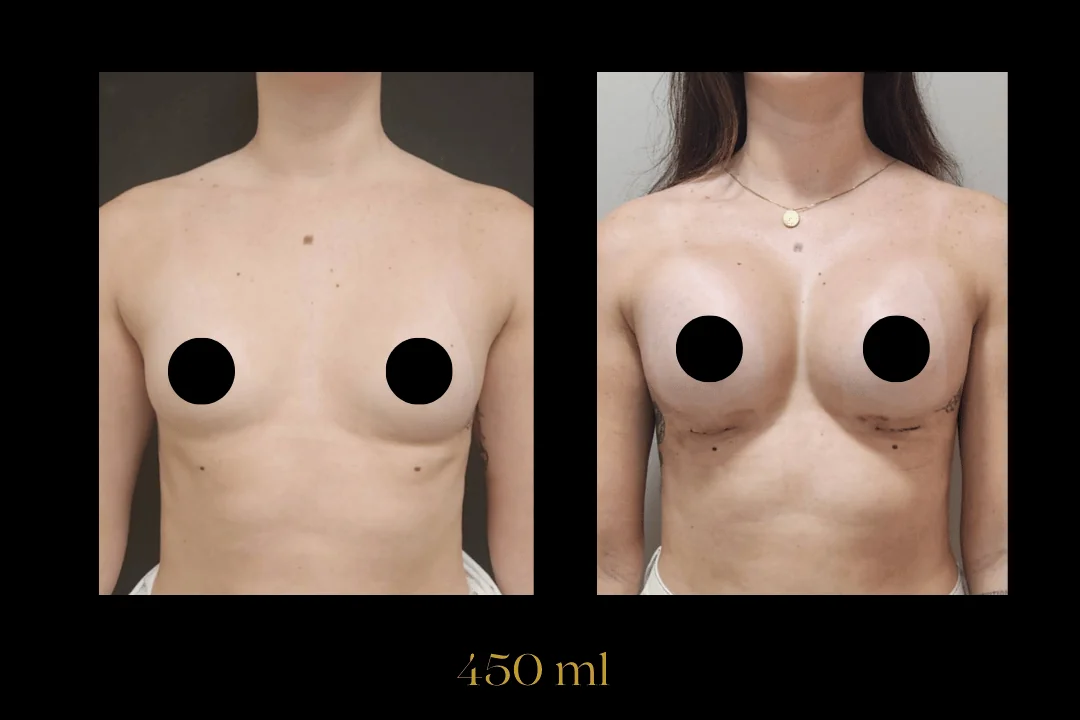 Caso 8 — antes e depois