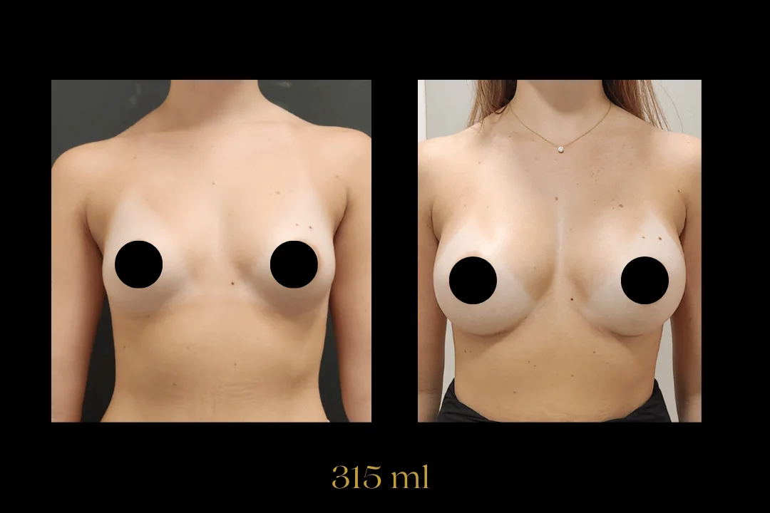 Caso 9 — antes e depois