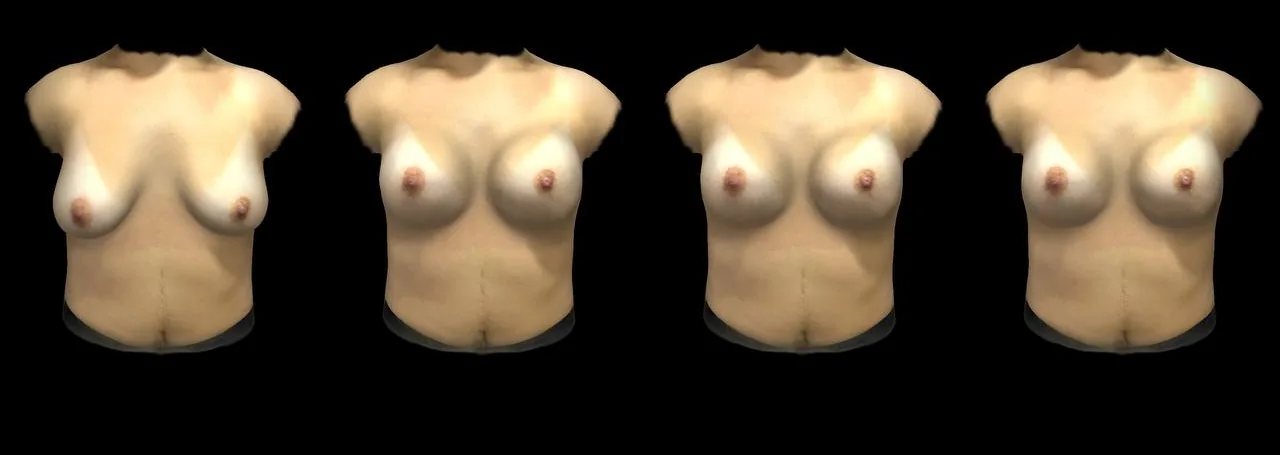 Simulação 3D Arbrea — vista frontal com opções de volume