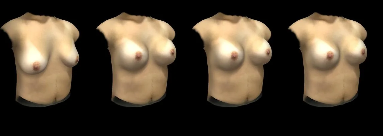Simulação 3D Arbrea — comparação de volumes em perspectiva